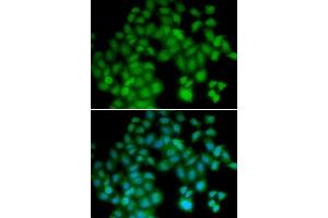 Immunofluorescence (IF) image for anti-Thymosin beta-4 (TMSB4X) antibody (ABIN1876626)