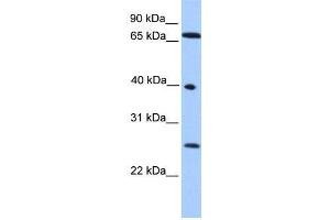 Human HeLa; WB Suggested Anti-L3MBTL2 Antibody Titration: 0. (L3MBTL2 antibody  (N-Term))
