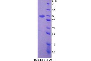 Image no. 1 for Septin 6 (SEPT6) (AA 87-327) protein (His tag) (ABIN6237132) (Septin 6 Protein (SEPT6) (AA 87-327) (His tag))