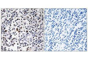 Immunohistochemistry (IHC) image for anti-CD302 (CD302) (Internal Region) antibody (ABIN1850248) (DCL1 antibody  (Internal Region))