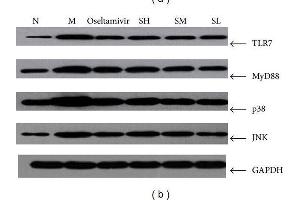 Mice were anesthetized and then infected intranasally by dropping 0. (TLR7 antibody  (AA 461-560))