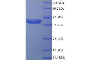 SDS-PAGE (SDS) image for Estrogen Receptor Binding Site Associated, Antigen, 9 (EBAG9) (AA 28-213), (Cytoplasmic Domain), (Cytosolic) protein (His-SUMO Tag) (ABIN4975466) (RCAS1 Protein (AA 28-213, Cytoplasmic Domain, Cytosolic) (His-SUMO Tag))