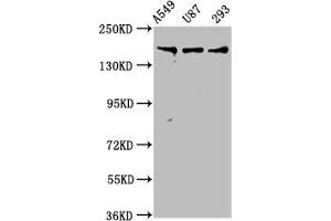 Western Blot Positive WB detected in: A549 whole cell lysate, U87 whole cell lysate, 293 whole cell lysate All lanes: AGRN antibody at 7.