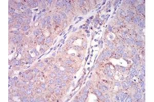 Immunohistochemistry (IHC) image for anti-SEC31 Homolog A (SEC31A) (AA 429-571) antibody (ABIN5542690)
