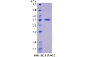 SDS-PAGE (SDS) image for Damage-Specific DNA Binding Protein 2, 48kDa (DDB2) (AA 212-407) protein (His tag) (ABIN2124598) (DDB2 Protein (AA 212-407) (His tag))