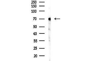 Western blot analysis of lysates from K562 cells(uv30 min treatment), using Phospho-Chk2 (Ser516) Antibody at 1/1000 dilution.