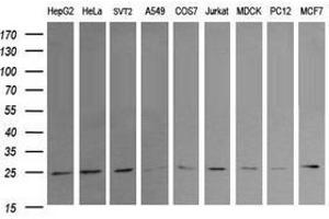 Image no. 2 for anti-RAB21, Member RAS Oncogene Family (RAB21) antibody (ABIN1500548) (RAB21 antibody)