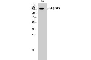 Western Blotting (WB) image for anti-Retinoblastoma 1 (RB1) (pSer780) antibody (ABIN5961788) (Retinoblastoma 1 antibody  (pSer780))