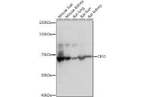 Western blot analysis of extracts of various cell lines, using CES1 Rabbit mAb (ABIN7266077) at 1:1000 dilution. (CES1 antibody)