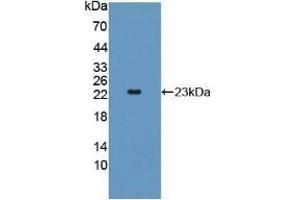 Detection of Recombinant AK2, Rat using Polyclonal Antibody to Adenylate Kinase 2 (AK2) (Adenylate Kinase 2 antibody  (AA 64-232))