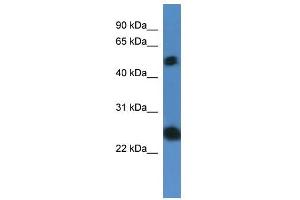 Western Blot showing SLA2 antibody used at a concentration of 1-2 ug/ml to detect its target protein. (SLAP2 antibody  (N-Term))