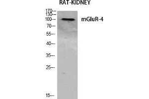 Western Blot analysis of various cells using mGluR-4 Polyclonal Antibody diluted at 1:500. (Metabotropic Glutamate Receptor 4 antibody  (AA 820-900))