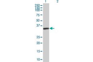 Western Blot analysis of PRKRA expression in transfected 293T cell line by PRKRA MaxPab polyclonal antibody.