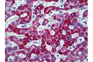 Anti-CPS1 antibody IHC of human liver. (CPS1 antibody  (AA 1400-1501))