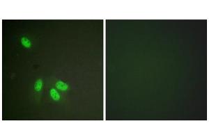 Immunofluorescence analysis of HeLa cells, using hnRPD (epitope around residue 83) antibody. (HNRNPD/AUF1 antibody  (Ser83))