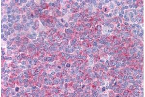 Human Tonsil: Formalin-Fixed, Paraffin-Embedded (FFPE) (HSP90AA1 antibody  (AA 108-157))