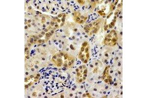 Immunohistochemical analysis of PSMB9 staining in mouse kidney formalin fixed paraffin embedded tissue section.
