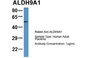Host: Rabbit  Target Name: ALDH9A1  Sample Tissue: Human Adult Placenta  Antibody Dilution: 1. (ALDH9A1 antibody  (C-Term))