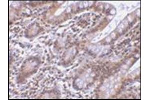 Immunohistochemistry of Livin in human small intestine tissue with this product at 5 μg/ml.