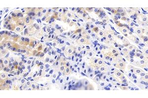 Detection of HGF in Mouse Stomach Tissue using Polyclonal Antibody to Hepatocyte Growth Factor (HGF) (HGF antibody  (AA 482-710))