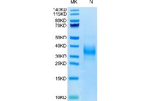 Sclerostin Protein (SOST) (AA 24-213) (His-Avi Tag,Biotin)