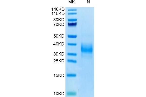 Sclerostin Protein (SOST) (AA 24-213) (His-Avi Tag,Biotin)