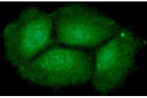 ICC/IF analysis of ING2 in Hep3B cells line, stained with DAPI (Blue) for nucleus staining and monoclonal anti-human ING2 antibody (1:100) with goat anti-mouse IgG-Alexa fluor 488 conjugate (Green). (ING2 antibody  (AA 1-280))