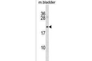 Rat Mycb Antibody (C-term) (ABIN1536682 and ABIN2850194) western blot analysis in mouse bladder tissue lysates (35 μg/lane).