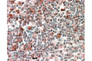 Immunohistochemistry (IHC) image for anti-Neutrophil Cytosolic Factor 4, 40kDa (NCF4) (Internal Region) antibody (ABIN190755)