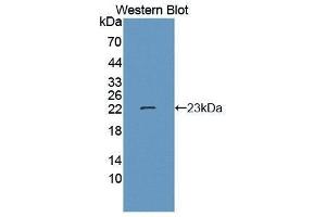 Western Blotting (WB) image for anti-N-Acetylgalactosaminidase, alpha (NAGA) (AA 218-411) antibody (ABIN1859954)
