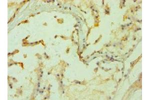 Immunohistochemistry of paraffin-embedded human prostate tissue using ABIN7169286 at dilution of 1:100