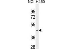 Western Blotting (WB) image for anti-Pyruvate Dehydrogenase (Lipoamide) alpha 2 (PDHa2) antibody (ABIN2995821)
