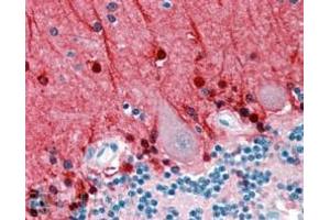 ABIN185628 (2. (Amphiphysin antibody  (Internal Region))