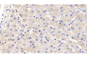 Detection of IL5 in Canine Liver Tissue using Polyclonal Antibody to Interleukin 5 (IL5) (IL-5 antibody  (AA 20-134))