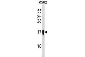 CCL7 Antibody (Center) western blot analysis in K562 cell line lysates (35µg/lane). (CCL7 antibody  (Middle Region))