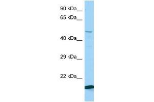 Host: Rabbit Target Name: Kbtbd2 Sample Type: Mouse Testis lysates Antibody Dilution: 1. (KBTBD2 antibody  (N-Term))