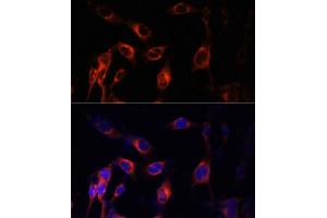Immunofluorescence analysis of NIH-3T3 cells using TSC1 Polyclonal Antibody (ABIN6133755, ABIN6149609, ABIN6149610 and ABIN6213968) at dilution of 1:100 (40x lens). (TSC1 antibody  (AA 550-650))