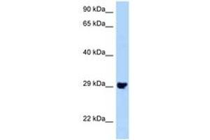 Image no. 1 for anti-Pleckstrin Homology Domain Containing, Family F (With FYVE Domain) Member 2 (PLEKHF2) (N-Term) antibody (ABIN6748203) (PLEKHF2 antibody  (N-Term))