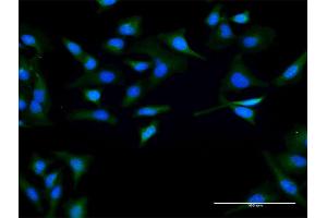Immunofluorescence of purified MaxPab antibody to SPO11 on HeLa cell. (SPO11 antibody  (AA 1-358))