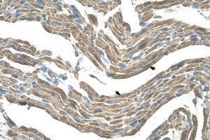 Image no. 1 for anti-Asporin (ASPN) (AA 250-299) antibody (ABIN203462) (Asporin antibody  (AA 250-299))