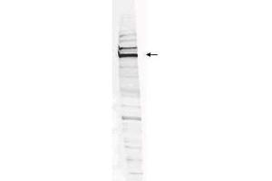Western blot analysis is shown using  Affinity Purified anti-Human WHIP antibody to detect Human WHIP present in a HEK293 whole cell lysate. (WRNIP1 antibody  (Internal Region, Isoform 1, Isoform 2))
