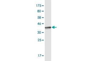 Western Blot detection against Immunogen (36. (KDM6A antibody  (AA 641-740))