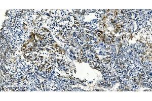 IHC analysis of TMBIM1 using anti-TMBIM1 antibody (ABIN7603190). (TMBIM1 antibody  (N-Term))