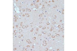 Immunohistochemistry of paraffin-embedded mouse brain using COPG2 antibody (ABIN7266426) at dilution of 1:100 (40x lens). (COPG2 antibody  (AA 542-871))