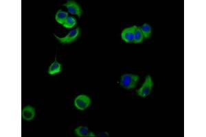 Immunofluorescence staining of MCF-7 cells with ABIN7161114 at 1:133, counter-stained with DAPI. (PVRL4 antibody  (AA 91-199))