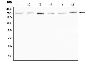 Western blot analysis of SCN11A using anti-SCN11A antibody (ABIN7603132).