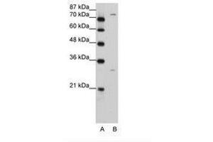 Image no. 2 for anti-Prostaglandin-Endoperoxide Synthase 1 (Prostaglandin G/H Synthase and Cyclooxygenase) (PTGS1) (AA 51-100) antibody (ABIN203401) (PTGS1 antibody  (AA 51-100))