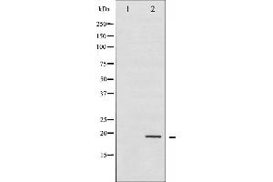 Western blot analysis of Stathmin 1 phosphorylation expression in PMA treated Jurkat whole cell lysates,The lane on the left is treated with the antigen-specific peptide.