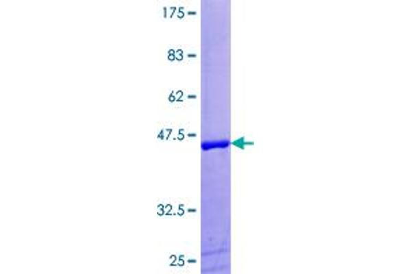 UBE2I Protein (AA 1-158) (GST tag)