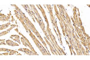 Detection of AST in Mouse Cardiac Muscle Tissue using Monoclonal Antibody to Aspartate Aminotransferase (AST) (GOT1 antibody  (AA 1-413))